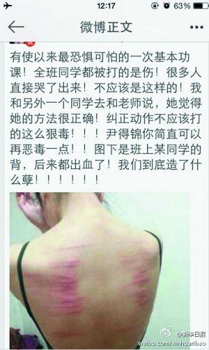 排舞伤不起，新手入门必看实用指南